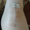 knee1.jpg
