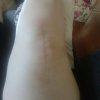 knee2.jpg