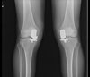 [Bonesmart.org] Greetings from the other side