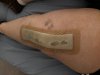[Bonesmart.org] SpaceGirls Road to Recovery Knee #2