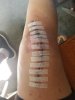 [Bonesmart.org] ArmyVet's recovery thread<<