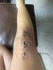 [Bonesmart.org] Muldoh’s one year old TKR!