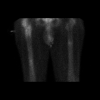 [Bonesmart.org] Life After SCaprae