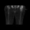 [Bonesmart.org] Life After SCaprae