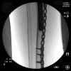 [Bonesmart.org] Lovetocookandsew’s long road to recovery