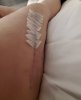 [Bonesmart.org] Lovetocookandsew’s long road to recovery