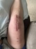 [Bonesmart.org] Knee Scars - Post Your Badges of Honor Here! NO CHIT-CHAT please