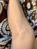 [Bonesmart.org] Knee Scars - Post Your Badges of Honor Here! NO CHIT-CHAT please