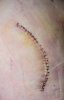 [Bonesmart.org] Hippies scars - post your badges of honor here: NO CHIT-CHAT HERE PLEASE