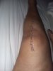 [Bonesmart.org] Knee Scars - Post Your Badges of Honor Here! NO CHIT-CHAT please