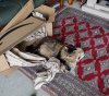 [Bonesmart.org] Now POST-op