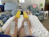 [Bonesmart.org] Bilateral Knee Replacement-Ups and Downs