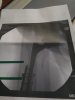 [Bonesmart.org] 7 days post-op RTHR