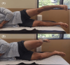 [Bonesmart.org] TKR 4/6 pain lifting bent leg