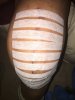 [Bonesmart.org] Daveboy1810 My August 11 TKR (left Knee)