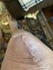 [Bonesmart.org] Knee Scars - Post Your Badges of Honor Here! NO CHIT-CHAT please