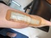 [Bonesmart.org] Susie-Q's 2nd TKR Recovery Thread