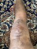 [Bonesmart.org] Knee Scars - Post Your Badges of Honor Here! NO CHIT-CHAT please