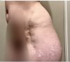 [Bonesmart.org] Hippies scars - post your badges of honor here: NO CHIT-CHAT HERE PLEASE