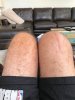 [Bonesmart.org] Knee Wobble Question