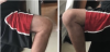 [Bonesmart.org] Knee Wobble Question