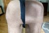 [Bonesmart.org] Knee Wobble Question