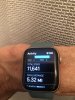 [Bonesmart.org] Reader's Left TKR Spacer Exchange