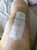 [Bonesmart.org] Knee Scars - Post Your Badges of Honor Here! NO CHIT-CHAT please