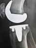 [Bonesmart.org] Knee Wobble Question