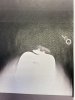 [Bonesmart.org] Sharon’s second knee recovery!