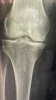 knee r.jpg