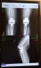 [Bonesmart.org] Round Two