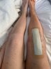 [Bonesmart.org] Knee Scars - Post Your Badges of Honor Here! NO CHIT-CHAT please