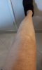 [Bonesmart.org] Knee Scars - Post Your Badges of Honor Here! NO CHIT-CHAT please