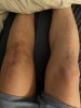 [Bonesmart.org] Stiffness - hard to do exercises