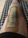 [Bonesmart.org] My Journey