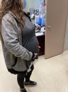 [Bonesmart.org] Sudden pain 2 1/2 years after hip revision