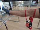 [Bonesmart.org] Post knee surgery realism