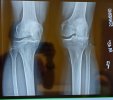 [Bonesmart.org] New, young, and afraid