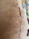 [Bonesmart.org] Knee Scars - Post Your Badges of Honor Here! NO CHIT-CHAT please