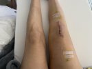 [Bonesmart.org] PartialFix -- Recovering...