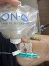 [Bonesmart.org] My TKR Was Worth It!