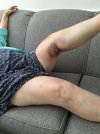 [Bonesmart.org] Suggestions needed for “tight band” feeling