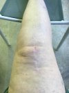 [Bonesmart.org] My Journey