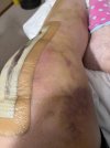 [Bonesmart.org] I’m needing encouragement. Sure glad I found this place.