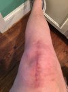 [Bonesmart.org] Suggestions needed for “tight band” feeling