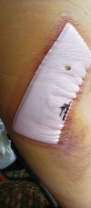 [Bonesmart.org] Boofit's recovery in Hong Kong