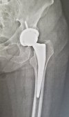 [Bonesmart.org] Boofit's recovery in Hong Kong
