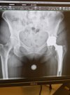 [Bonesmart.org] Dog Lovers Recovery