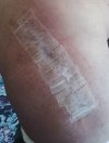 [Bonesmart.org] Hippies scars - post your badges of honor here: NO CHIT-CHAT HERE PLEASE